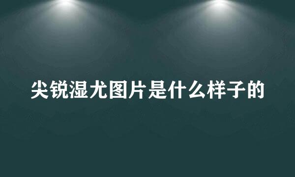 尖锐湿尤图片是什么样子的