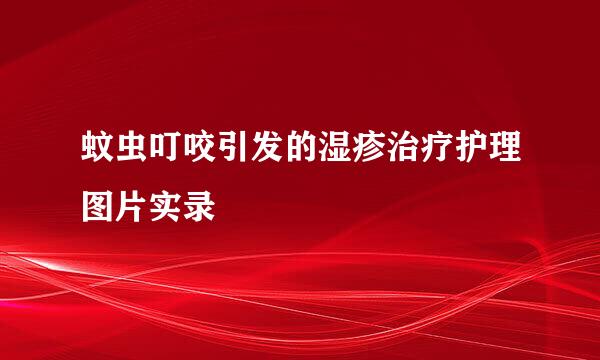 蚊虫叮咬引发的湿疹治疗护理图片实录
