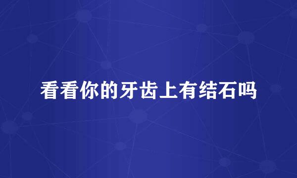 看看你的牙齿上有结石吗