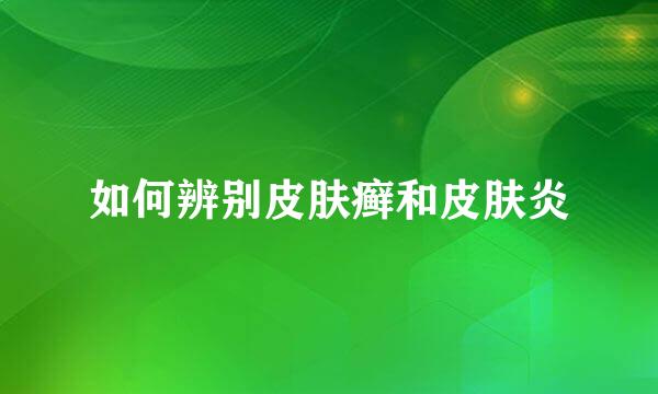 如何辨别皮肤癣和皮肤炎