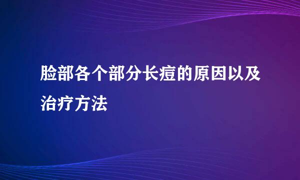 脸部各个部分长痘的原因以及治疗方法