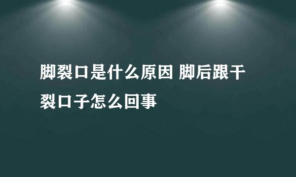 脚裂口是什么原因 脚后跟干裂口子怎么回事