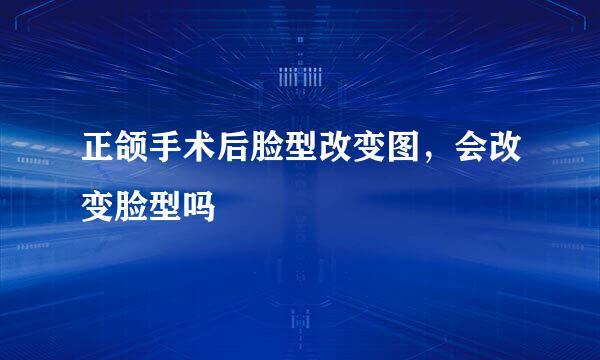 正颌手术后脸型改变图，会改变脸型吗