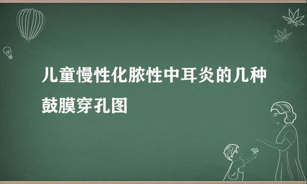 儿童慢性化脓性中耳炎的几种鼓膜穿孔图