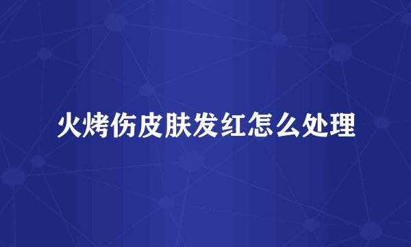 火烤伤皮肤发红怎么处理