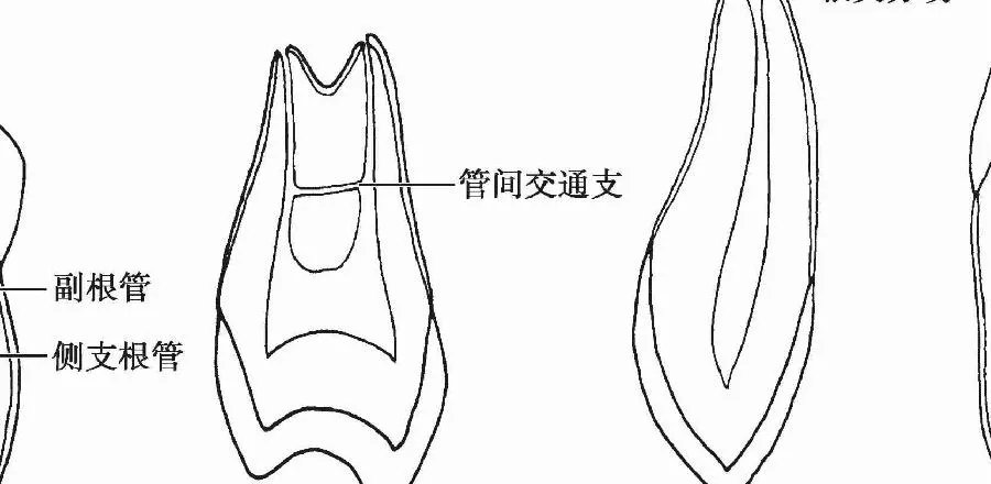 【图】牙根管系统详解