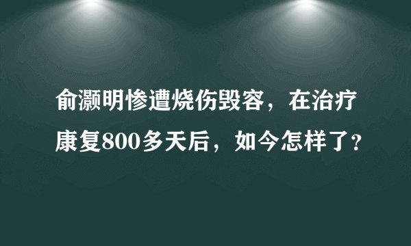 俞灏明惨遭烧伤毁容，在治疗康复800多天后，如今怎样了？