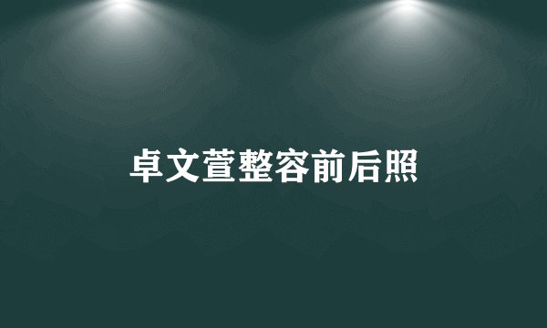 卓文萱整容前后照