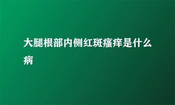 大腿根部内侧红斑瘙痒是什么病