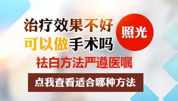 治疗白癜风邯郸白癜风医院怎么选择