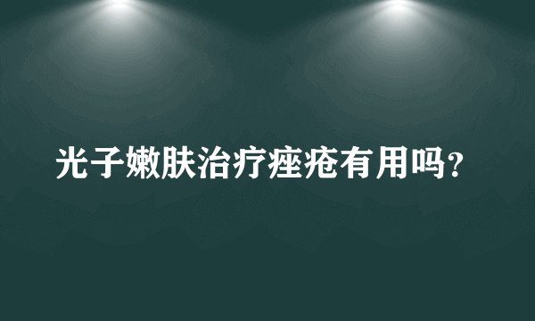 光子嫩肤治疗痤疮有用吗？