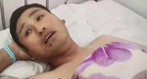 患者右腿做手术左腿被误割开医院怎么说?