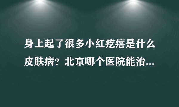 身上起了很多小红疙瘩是什么皮肤病？北京哪个医院能治疗红疙瘩