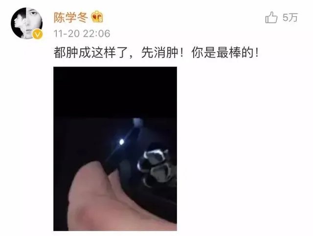 你怎么看待2017维密秀现场奚梦瑶踩到翅膀摔倒在舞台 ?