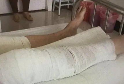 患者右腿做手术左腿被误割开医院怎么说?