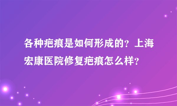 各种疤痕是如何形成的？上海宏康医院修复疤痕怎么样？
