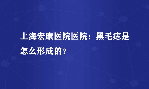 上海宏康医院医院：黑毛痣是怎么形成的？
