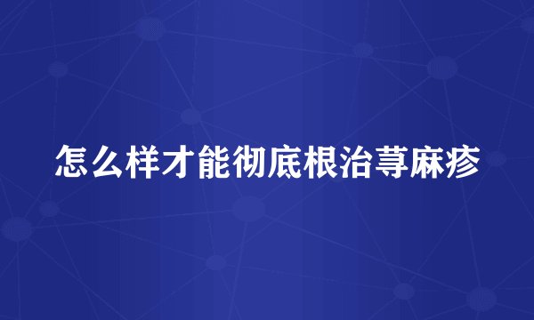 怎么样才能彻底根治荨麻疹