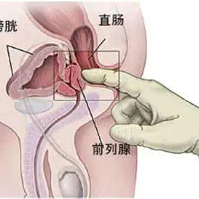 如何治疗阳痿病?