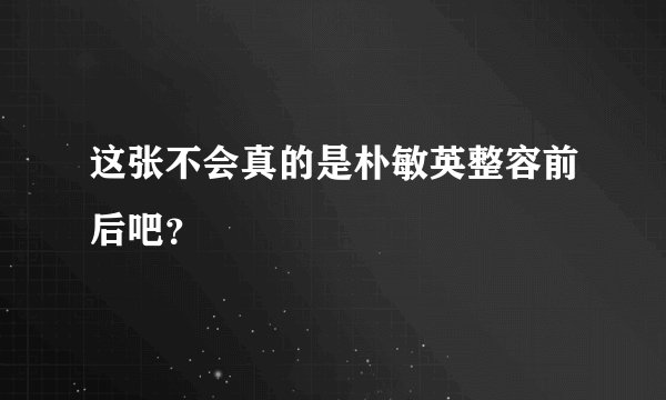 这张不会真的是朴敏英整容前后吧？