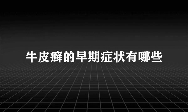牛皮癣的早期症状有哪些