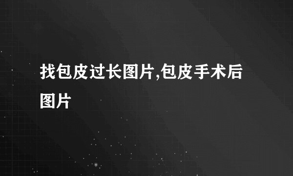 找包皮过长图片,包皮手术后图片