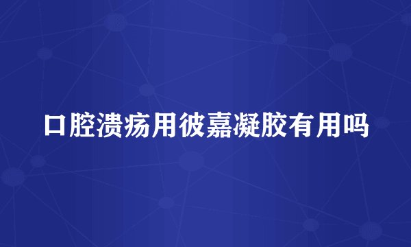 口腔溃疡用彼嘉凝胶有用吗