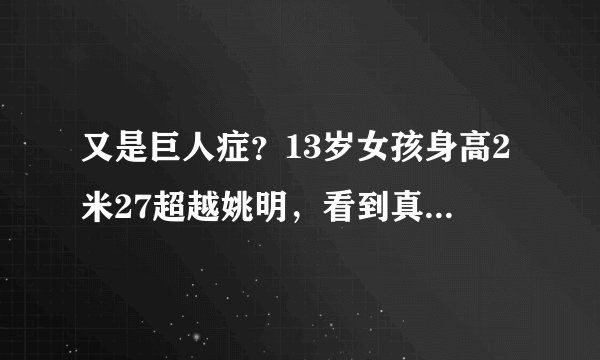 又是巨人症？13岁女孩身高2米27超越姚明，看到真相后大家都乐了
