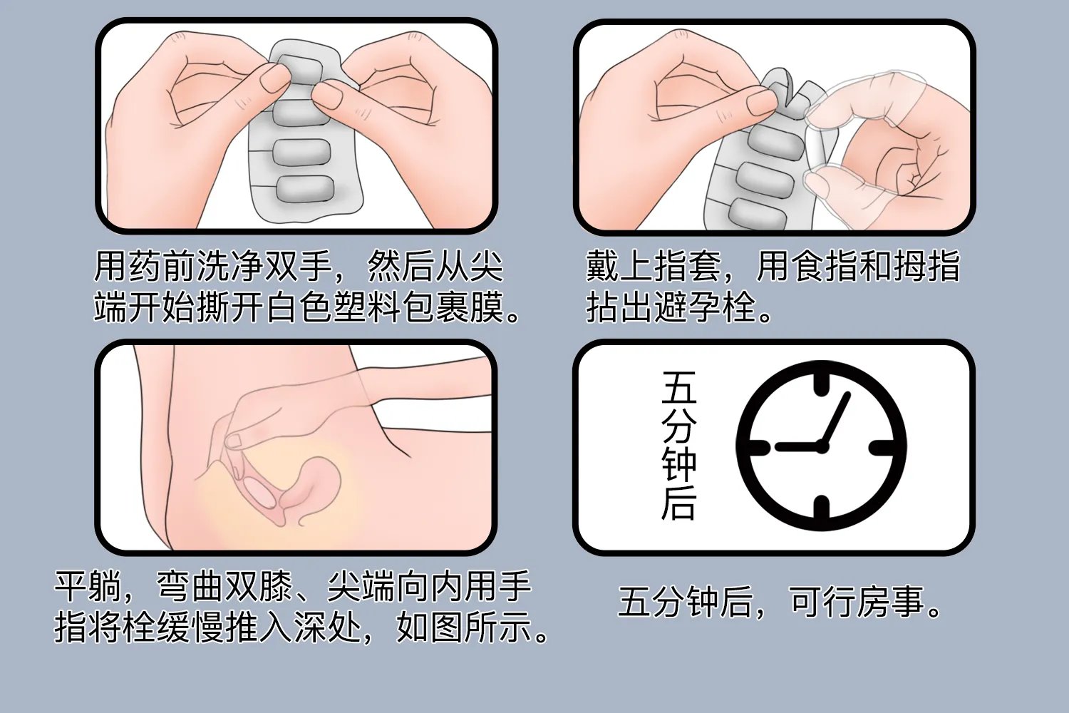 避孕栓的使用方法图解