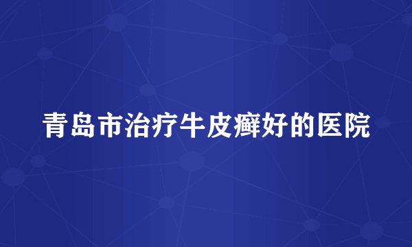 青岛市治疗牛皮癣好的医院
