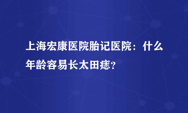 上海宏康医院胎记医院：什么年龄容易长太田痣？