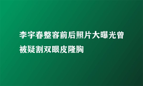 李宇春整容前后照片大曝光曾被疑割双眼皮隆胸