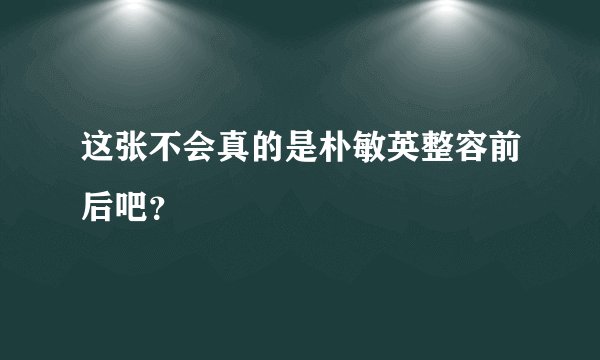 这张不会真的是朴敏英整容前后吧？
