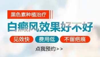 治疗白癜风邯郸白癜风医院怎么选择
