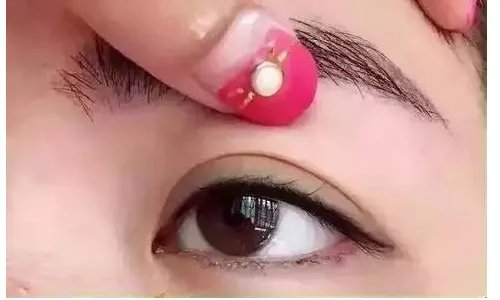 割双眼皮费用是多少