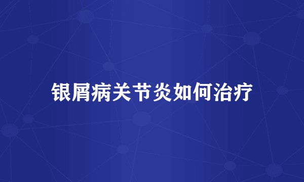 银屑病关节炎如何治疗