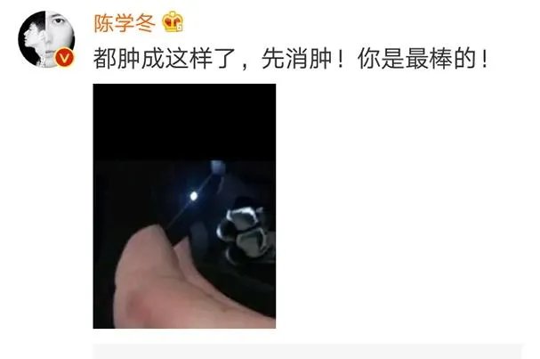 你怎么看待2017维密秀现场奚梦瑶踩到翅膀摔倒在舞台 ?