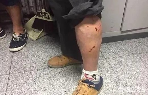 家里从小养的狗，疫苗该打的都打，会咬人吗？或者说会在什么情况下咬人？