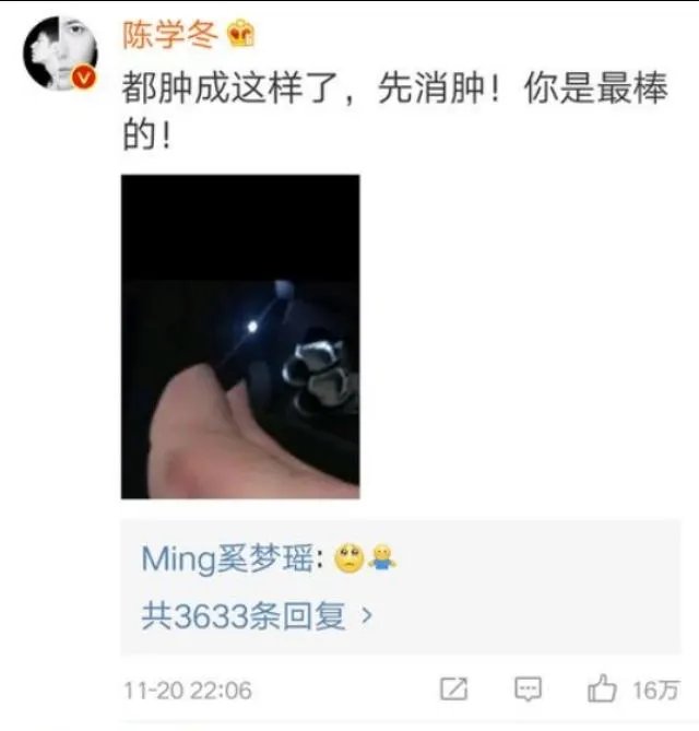 你怎么看待2017维密秀现场奚梦瑶踩到翅膀摔倒在舞台 ?