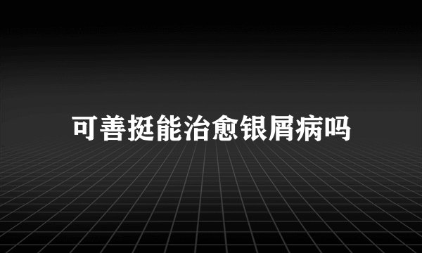 可善挺能治愈银屑病吗