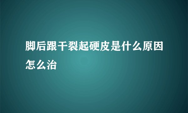 脚后跟干裂起硬皮是什么原因怎么治
