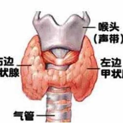 甲亢怎么回事北京北城?