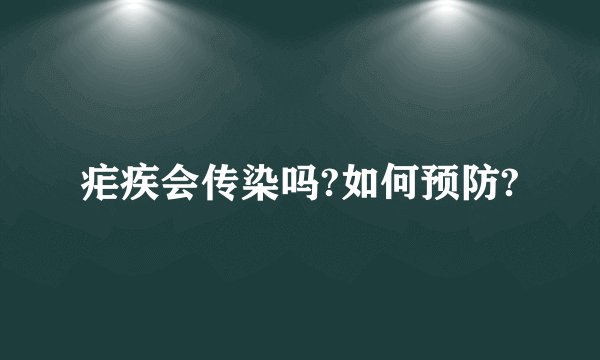 疟疾会传染吗?如何预防?
