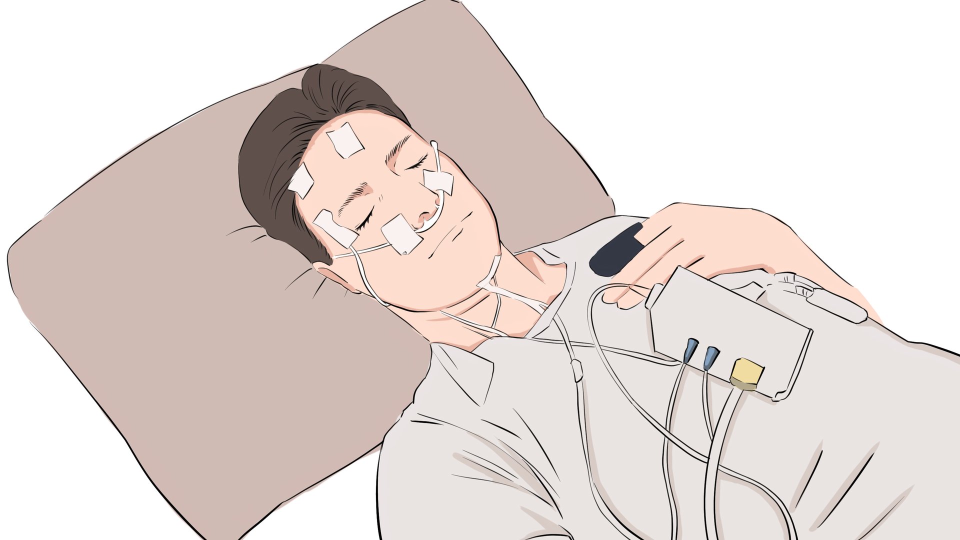 多导睡眠监测