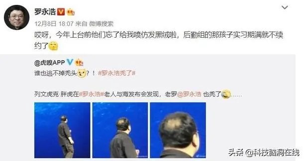 罗永浩秃顶的原因是什么?