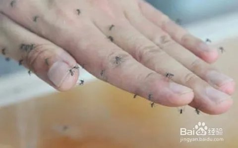 小腿被蚊子叮溃烂怎么办?蚊子咬了很痒怎么办?