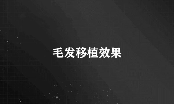 毛发移植效果