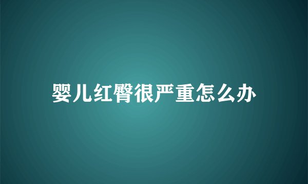 婴儿红臀很严重怎么办