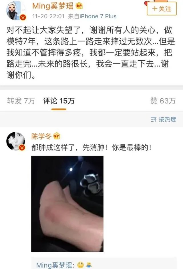 你怎么看待2017维密秀现场奚梦瑶踩到翅膀摔倒在舞台 ？