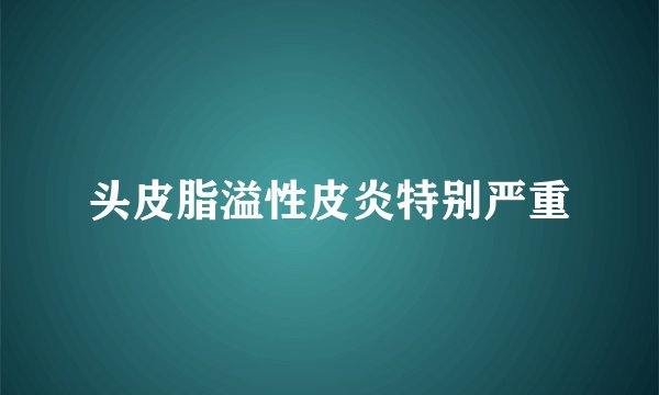 头皮脂溢性皮炎特别严重